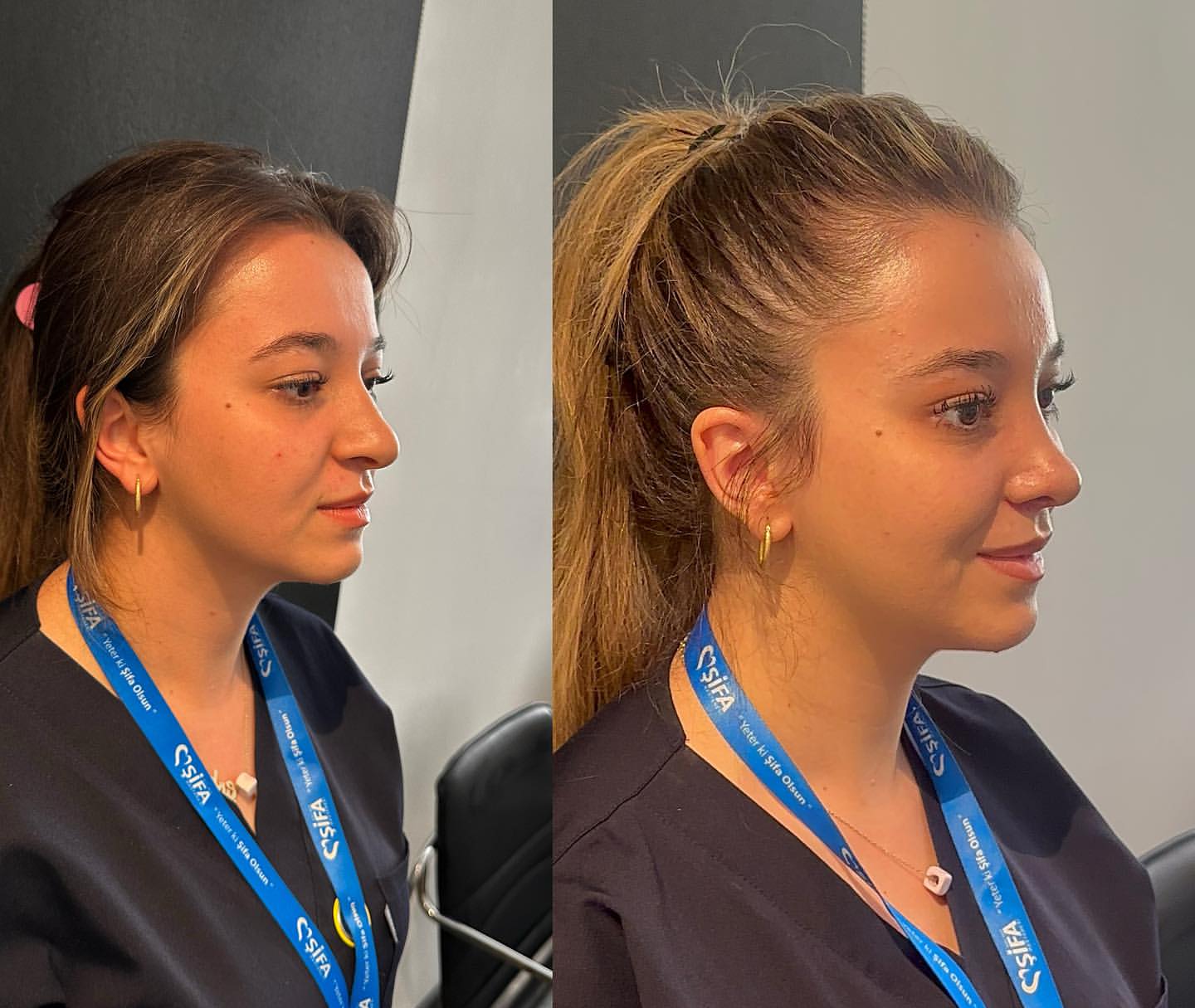 op-dr-sefa-kesan-burun-kepce-kulak-estetigi-0 (48)